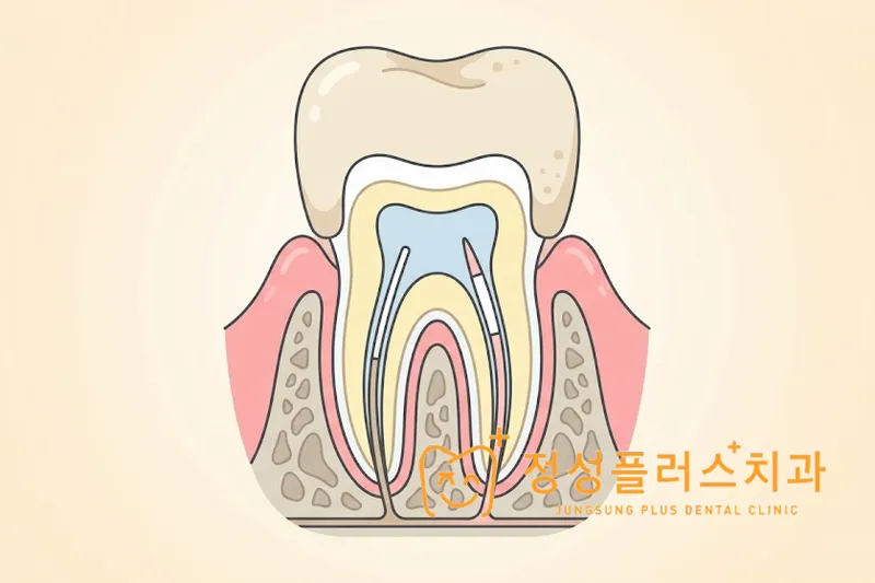 부천 치과 임시치아가 깨지거나 빠졌어요, 주말엔 어떻게 해야 하나요?