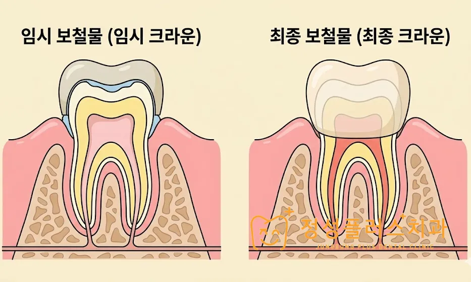 부천 치과 임시치아가 깨지거나 빠졌어요, 주말엔 어떻게 해야 하나요?