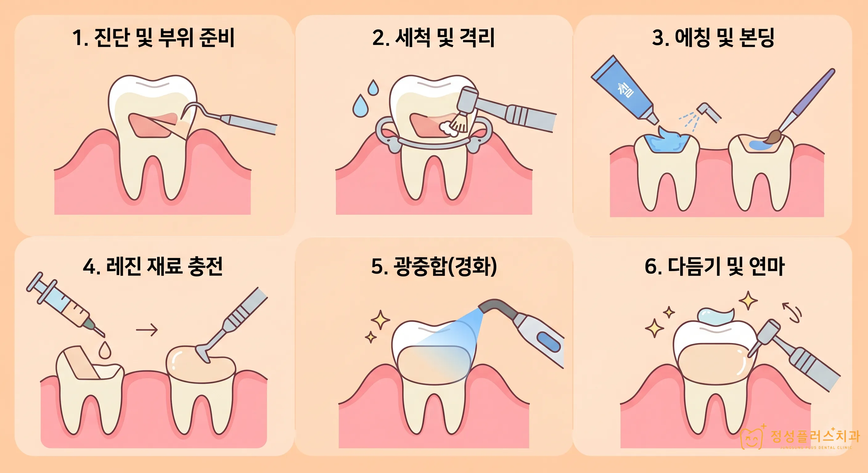 화곡 치과 양치할 때 찬물이 닿으면 소름 끼치게 시린 이유가 있습니다.